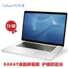 (笔记本电脑贴膜图片15.6英寸)观看最新笔记本电脑贴膜高清图片，保护你的电脑屏幕免受损坏