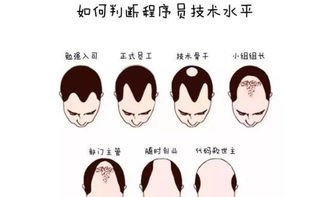 发际线有救了，新技术让脱发成为过去，重新找回自信和青春的秘诀曝光